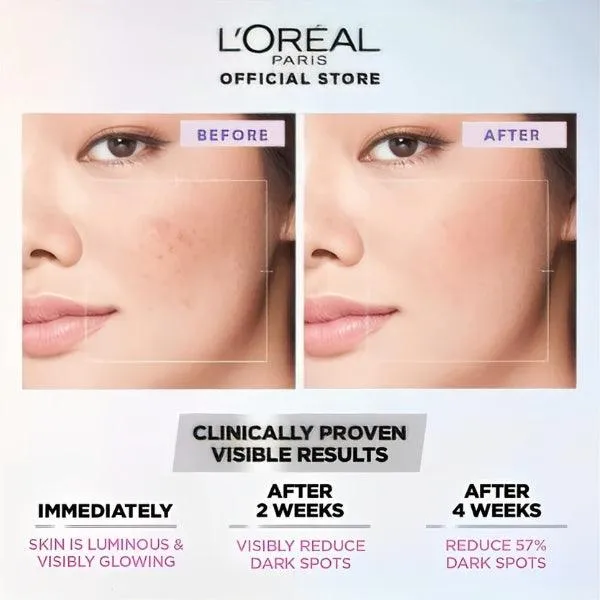 Loreal Paris Glycolic Bright Serum 30ml